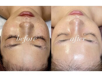 レシェルサロン(Lechelle Salon)/ダクトピール