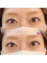 ユーロ(EURO)/アンドヘルシー100本