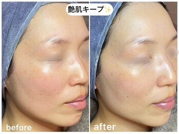 フラックス 京都(FLUX)/【エンビロン】顧客さまコース