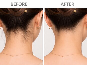 スムース(SMOOTH)/首元スッキリうなじワックス