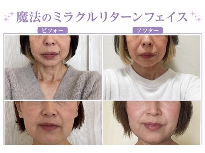 じゆう(J∞YOU)の写真