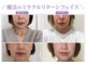 じゆう(J∞YOU)の写真