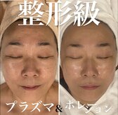 トータルエステティック ジョワイユ(JOYEUX)