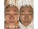 トータルエステティック ジョワイユ(JOYEUX)の写真