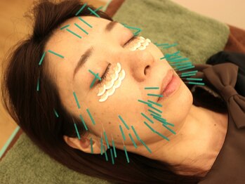 はしもと鍼灸整骨院/◇施術