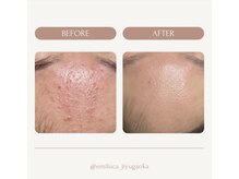 エミルカ 自由が丘店(EMILUCA)/ビフォーアフター