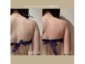 シャルナ(Chaluna)