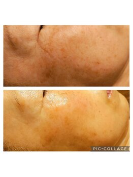 ルピナス(Lupinus.)/ビフォーアフター写真☆