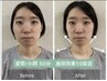 ＼大満足のお声多数／顔の歪み&大きさ改善+骨盤矯正+小顔矯正¥15,900→¥3,500