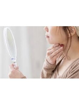 小顔になりたい