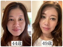 リラビューティー(Lilas Beauty)の雰囲気（代表本人が整形、医療無、当店のエステだけで顔が変わりました！）