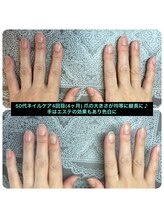 桃の木 吉祥寺店/ビフォーアフター　ハリ弾力ケア