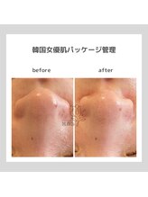 ポムハヌル(pom.haneul)/韓国肌管理室