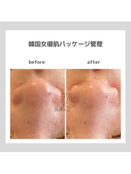 ポムハヌル(pom.haneul)/韓国肌管理室