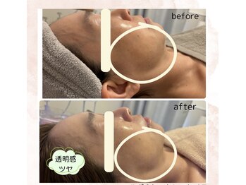 ラン(Ran)/ハンド＋シークレットmes