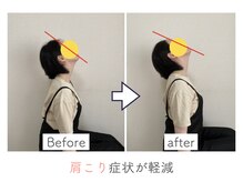 整体あゆむ 立川店/before after１
