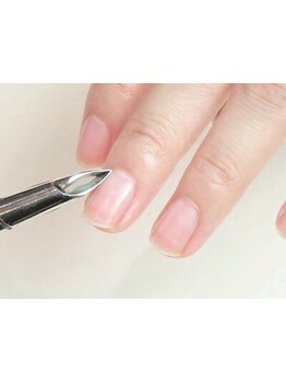 爪の悩みを解消できる（ケア含む）