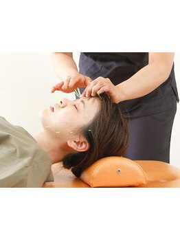 鍼灸施術を受けたい