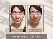 トーティシェル(tortoise shell)