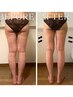 【美脚コース】セル脂肪を徹底分解!下半身痩せはコレ！￥7800→￥6800 100分