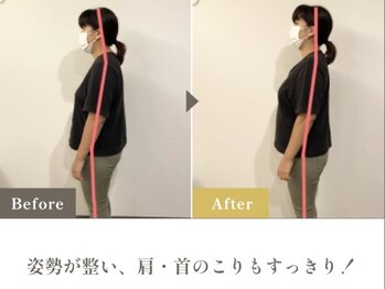 整体 寿 横浜院(KOTOBUKI)/横浜/横浜市/整体/肩こり