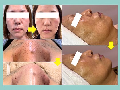 プレジール(plaisir)の写真