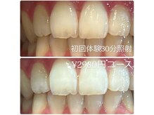ホワイトニングルーム 横浜店(Whitening Room)/セルフホワイトニング/横浜
