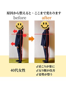 アキ整体(AKI整体)/慢性腰痛・姿勢改善の症例2