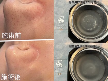 スムース(Smoooth)の写真