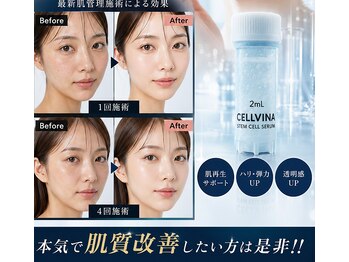 リュクシア(LUXIA)の写真/【本気の肌管理フルコース】5つの工程で徹底アプローチ！短期間で集中的に悩みにアプローチし効果実感◎