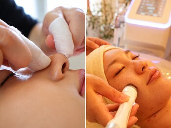 リエラ(Liella)の写真/切らないたるみ改善【毛穴洗浄+たるみVリフトマシン★￥8800】輪郭・口横のもたつきをキュッと引き上げ♪