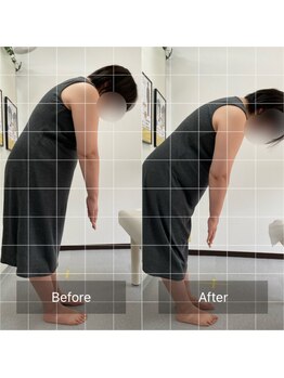 ナオル整体 池袋院(NAORU整体)/骨盤矯正の施術前後