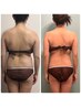 繰り返すリバウンドに終止符を！【美骨メソッド】