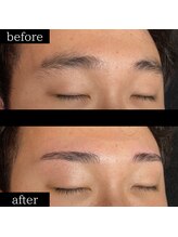 ユー 千葉駅前店(you)/症例写真