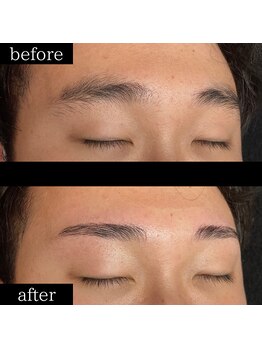 ユー 千葉駅前店(you)/症例写真