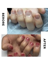 リミズネイルビューティー 名駅店(RimisNailxbeauty)/【美爪育成】深爪・噛み爪改善