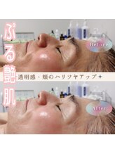 ビキャン(Can)/お客様の変化をご紹介します♪