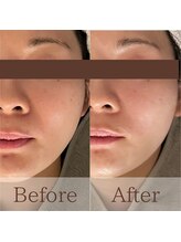 凪眠/小顔リンパフェイシャルの効果56