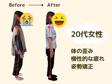 アロゼ/姿勢矯正　20代女性