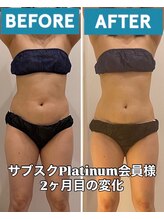 ヴォアール 東静岡店(VOIR)/サブスクプラチナ会員様