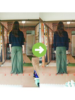 サプライズ整体院/30代ママさんの産後の骨盤初回