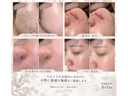 ベル 銀座(Belle)の写真