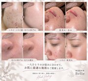 ベル 銀座(Belle)