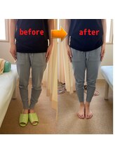 あべ整骨院 整体院/O脚矯正
