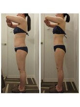 グレイスボディ BiViつくば店(Grace Body)/◆痩身　症例写真