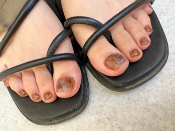 ラーム(Rarm)/foot brown nail