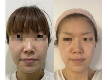 ラスティック(rustique)/私自身も肌が生まれ変わりました