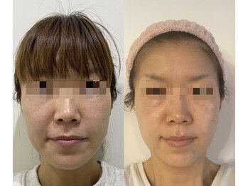ラスティック(rustique)/私自身も肌が生まれ変わりました