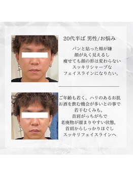 メディカルエステ 東銀座店/30代前半 男性