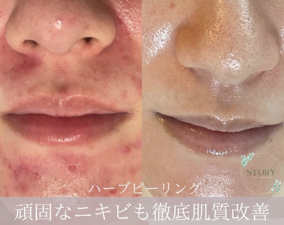 ストーリー 岐阜店(STORY)｜ホットペッパービューティー